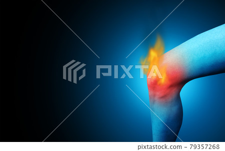Painful Knee Painful Knee 79357268