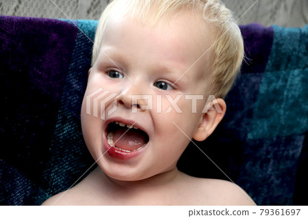 The boy has a broken wound on the lips 79361697