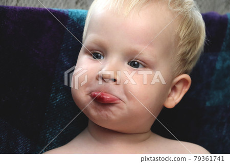 The boy has a broken wound on the lips The boy has a broken wound on the lips 79361741