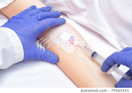 The doctor injects the medicine from a syringe into the female patient's venous catheter. Pain reliever and anti-inflammatory agent, vasodilator 79365433