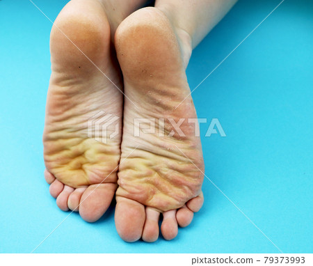 Cleaning foot feet with a saw or brush. Cleaning the feet of the fungus 79373993
