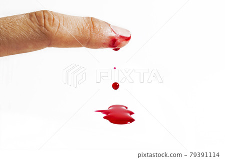 wound with blood on finger over white 79391114