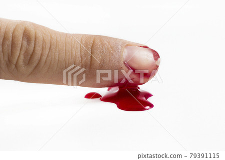 wound with blood on finger over white wound with blood on finger over white 79391115
