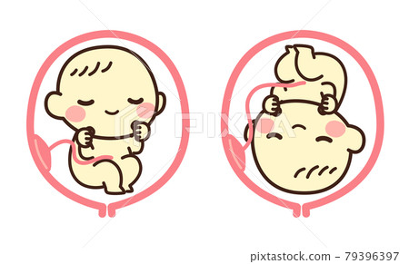 Fetal breech illustration Fetal breech illustration 79396397