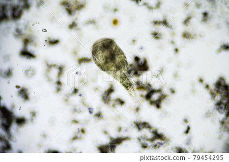 Ciliates Stentor found in freshwater pond under the light microscope 79454295
