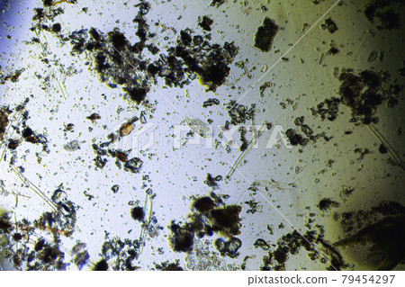 Stylonichia mytilus and microalgae under the light microscope 79454297