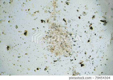 A lot of ciliates under the light microscope 79454304