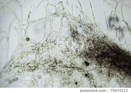 Kombucha tea macro close up under the light microscope, magnification of 100 times, microscope objective 10 79454313