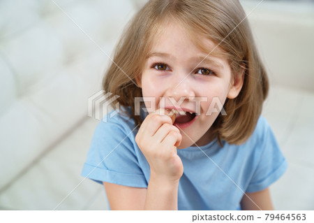 Little girl shows a reeling tooth. changing milk teeth to indigenous teeth. 79464563