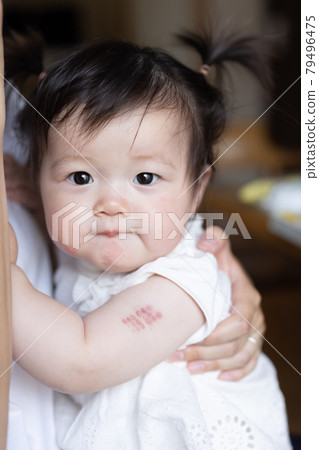Cute toddler inoculated with BCG 79496475