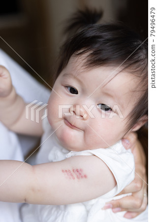 Cute toddler inoculated with BCG 79496479