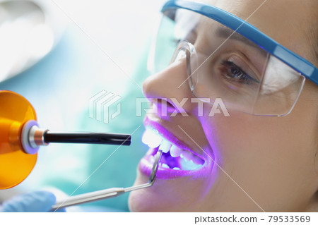 Doctor dentist shining on teeth of female patient curing light closeup Doctor dentist shining on teeth of female patient curing light closeup 79533569