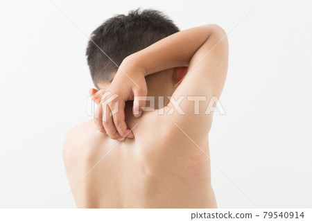 Children scratching their bodies 79540914