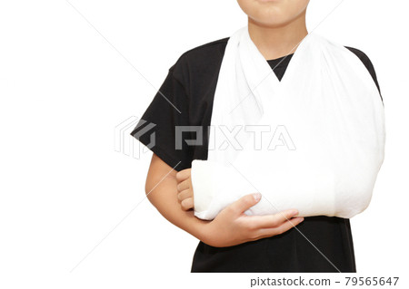 Fracture of a child's arm, cast fixed image 79565647