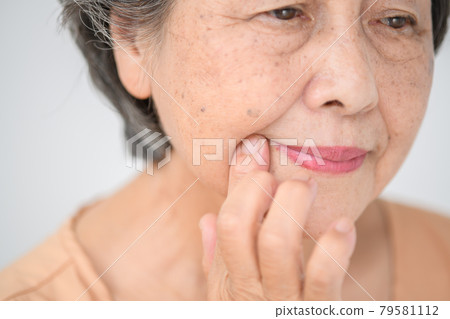 Senior female Nasolabial fold aging care 79581112