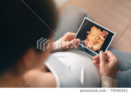 Asian pregnant woman holding ultrasound 4d scan image, Expectation of a child and Maternity prenatal care and woman pregnancy concept. Asian pregnant woman holding ultrasound 4d scan image, Expectation of a child and Maternity prenatal care and woman pregnancy concept. 79590261