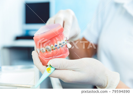 Dentist holding orthodontics braces in hand 79594890
