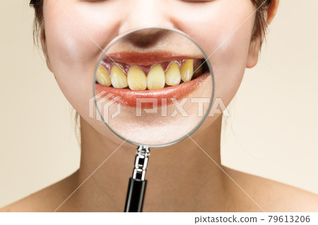 Enlarge yellowed teeth with a loupe 79613206