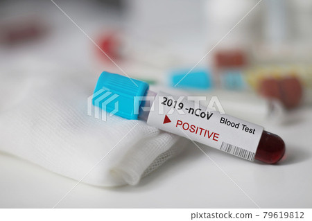Positive blood test result for the new rapidly spreading Coronavirus, originating in Wuhan, China. Test tube with blood sample.  Pandemic infectious concept 79619812