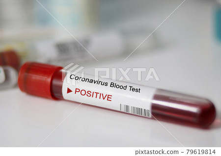 Positive blood test result for the new rapidly spreading Coronavirus, originating in Wuhan, China. Test tube with blood sample. Pandemic infectious concept Positive blood test result for the new rapidly spreading Coronavirus, originating in Wuhan, China. Test tube with blood sample. Pandemic infectious concept 79619814
