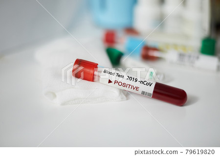 Positive blood test result for the new rapidly spreading Coronavirus, originating in Wuhan, China. Test tube with blood sample.  Pandemic infectious concept 79619820
