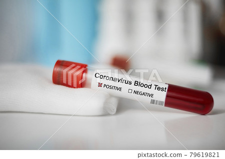 Positive blood test result for the new rapidly spreading Coronavirus, originating in Wuhan, China. Test tube with blood sample.  Pandemic infectious concept 79619821