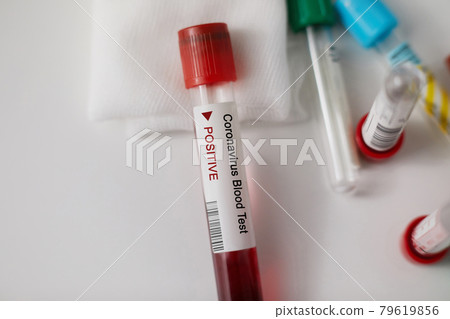 Positive blood test result for the new rapidly spreading Coronavirus, originating in Wuhan, China. Coronavirus 2019-nCoV Blood Sample. blood samplec Positive blood test result for the new rapidly spreading Coronavirus, originating in Wuhan, China. Coronavirus 2019-nCoV Blood Sample. blood samplec 79619856