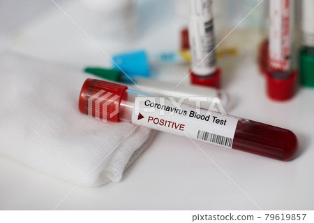 Positive blood test result for the new rapidly spreading Coronavirus, originating in Wuhan, China. Test tube with blood sample. Pandemic infectious concept Positive blood test result for the new rapidly spreading Coronavirus, originating in Wuhan, China. Test tube with blood sample. Pandemic infectious concept 79619857