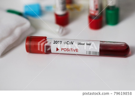 Positive blood test result for the new rapidly spreading Coronavirus, originating in Wuhan, China. Coronavirus 2019-nCoV Blood Sample. blood samplec Positive blood test result for the new rapidly spreading Coronavirus, originating in Wuhan, China. Coronavirus 2019-nCoV Blood Sample. blood samplec 79619858