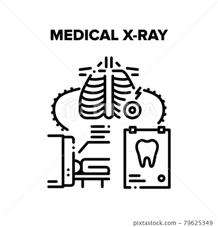 Medical X-ray Clinic Tool Vector Black Illustration Medical X-ray Clinic Tool Vector Black Illustration 79625349