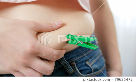Closeup of overweight woman holding fat fold on her big belly and putting on clothespin. Concept of excessive weight, obese female, dieting and overweight problems Closeup of overweight woman holding fat fold on her big belly and putting on clothespin. Concept of excessive weight, obese female, dieting and overweight problems 79625472