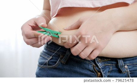Closeup of hanging clothespin on belly fat folds. Concept of excessive weight, obese female, dieting and overweight problems Closeup of hanging clothespin on belly fat folds. Concept of excessive weight, obese female, dieting and overweight problems 79625478
