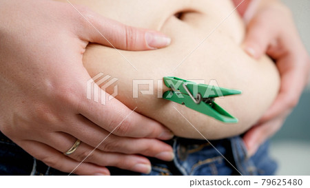 Closeup of young woman thinking of dieting and loosing weight putting clothespin on big fat belly. Concept of excessive weight, obese female, dieting and overweight problems 79625480