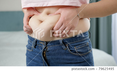 Young woman touching her big belly and holding fat folds. Concept of excessive weight, obese female, dieting and overweight problems 79625495