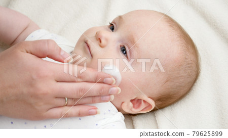CLoseup of applying moisturizing creme on baby skin suffering from dermatitis. Concept of newborn baby health and skin care 79625899