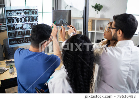 Group of four multiracial doctors looking and discussing x-ray in modern clinic or hospital 79636488