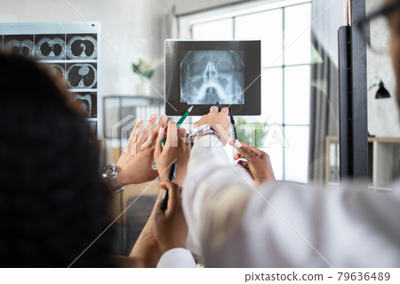 Hands of medical multiethnic team, pointing at x-ray scan of patient's head, discussing diagnosis Hands of medical multiethnic team, pointing at x-ray scan of patient's head, discussing diagnosis 79636489