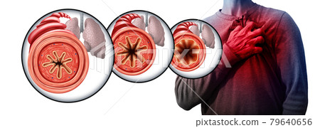 Asthma And Chest Pain 79640656