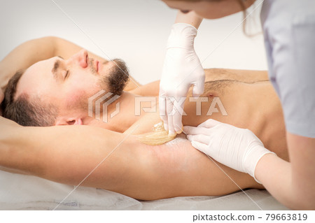 Young caucasian man receiving hair removal from his armpit in a beauty salon, depilation men's underarm. Young caucasian man receiving hair removal from his armpit in a beauty salon, depilation men's underarm. 79663819