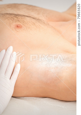 Young caucasian man receiving hair removal from his armpit in a beauty salon, depilation men's underarm. Young caucasian man receiving hair removal from his armpit in a beauty salon, depilation men's underarm. 79663820