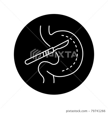 Stomach surgery olor line icon. Pictogram for web page, mobile app, promo. Stomach surgery olor line icon. Pictogram for web page, mobile app, promo. 79741266