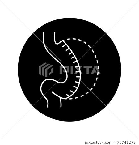 Sleeve gastrectomy olor line icon. Pictogram for web page, mobile app, promo. 79741275