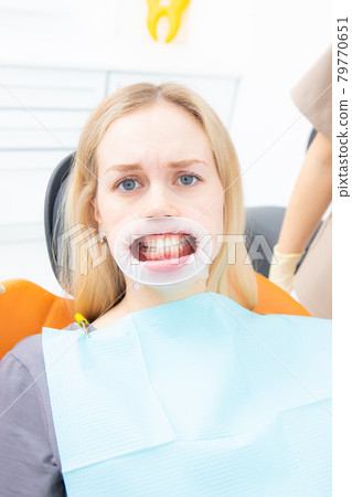 Patient with retractor in dentist office looking at camera 79770651