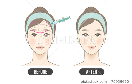 Wrinkle treatment (color) 79939630