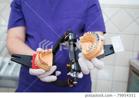 model of the jaw in the articulator in the hand of a young doctor. The dentist shows the unfolded articulator 79954351