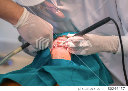 dentist cleaning the teeth patient with ultrasonic tool dentist cleaning the teeth patient with ultrasonic tool 80246457