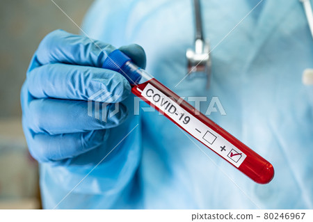 Positive blood infection sample in test tube for covid-19 coronavirus in lab. Scientist holding to check and analyze for patient in hospital. 80246967