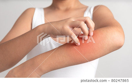 Itching in man 80247865