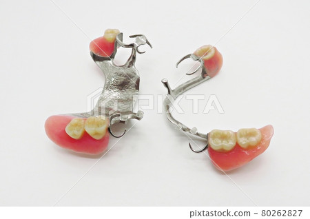 上下局部假牙 80262827