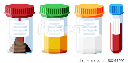 Test Tubes with Caps. Stool, Blood, Urine, Sperm. Test Tubes with Caps. Stool, Blood, Urine, Sperm. 80265091